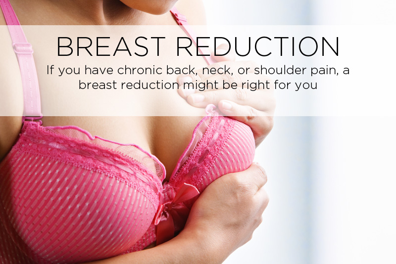 breast-reduction