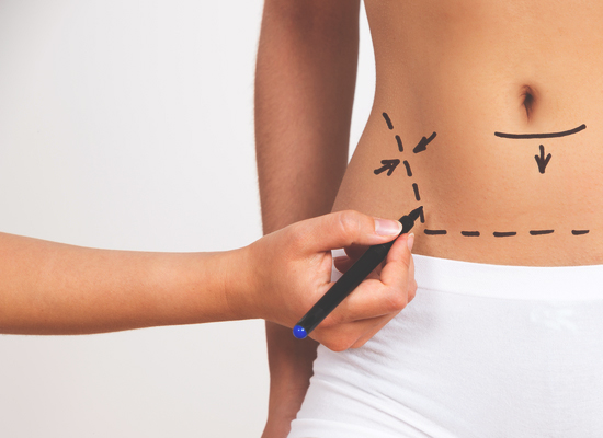 Liposuction - Mayo Clinic