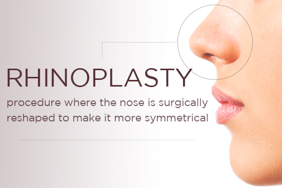 rhinoplasty