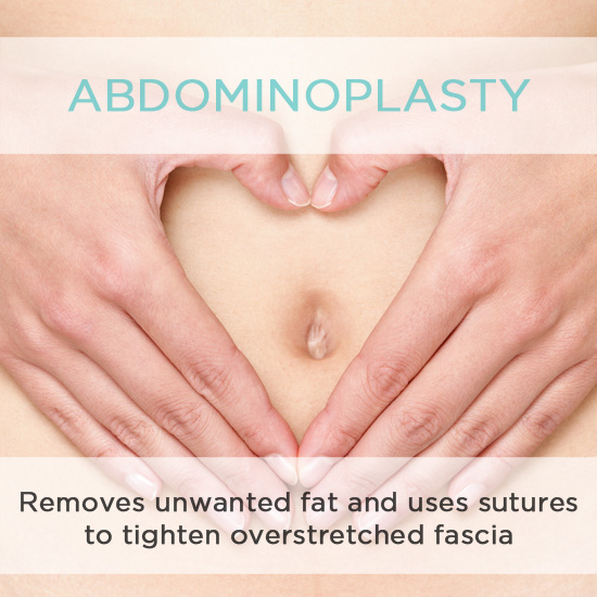 Abdominoplasty