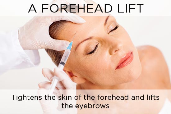forehead-lift-2