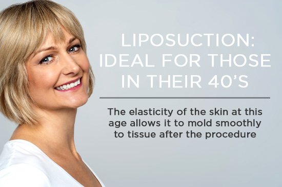 liposuction for 40s
