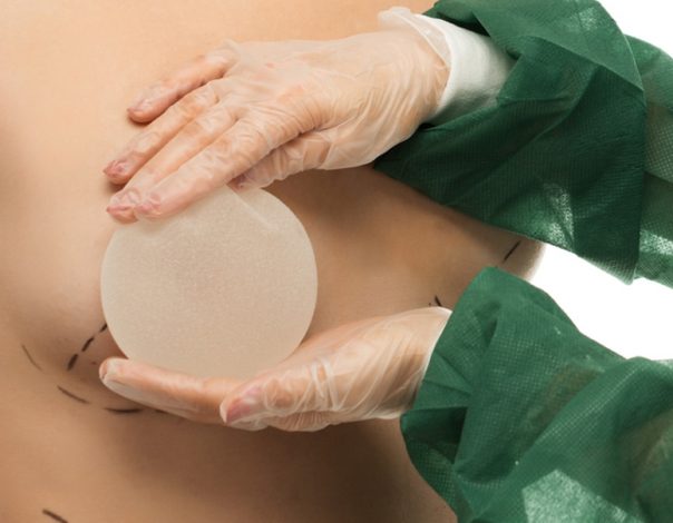 How-Breast-Implants