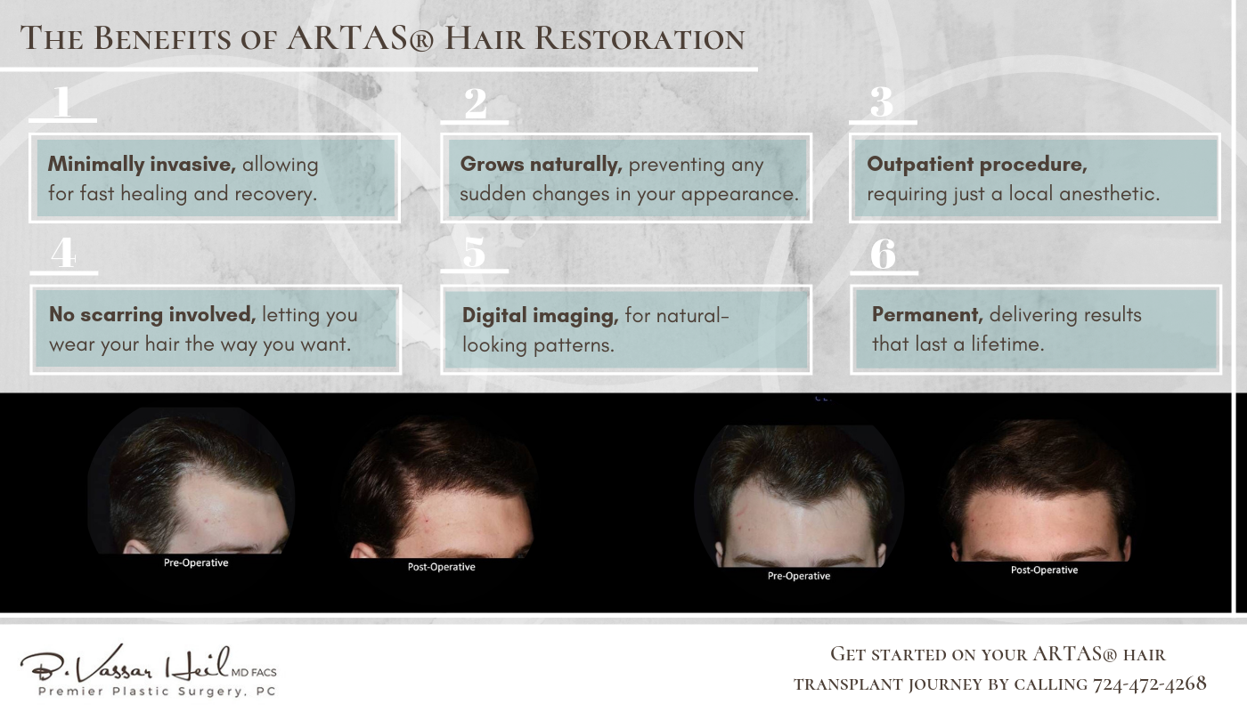 THE BENEFITS OF ARTAS® HAIR RESTORATION Premier Plastic